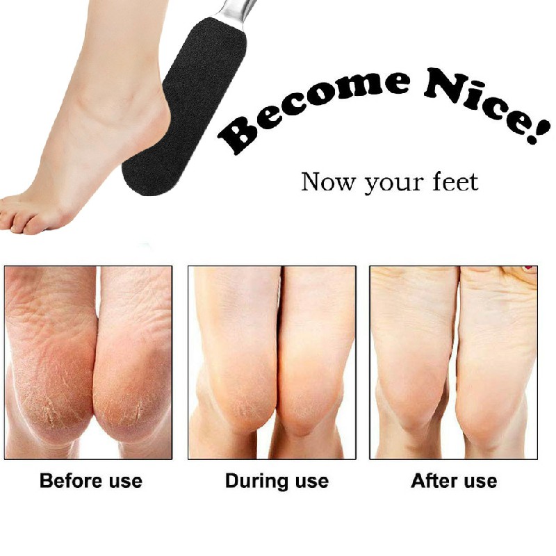 10 pcs Foot Files Pedicure Callus Feet Rasp Replacement Pads